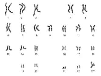 Chromosomes humains (caryotype) - crédits : © NHGRI