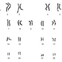 Chromosomes humains (caryotype) - crédits : © NHGRI