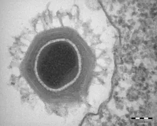 Virus géant au microscope électronique - crédits : © D. Raoult, N. Aldrovandi/ CNRS
