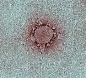 Virus du SRAS - crédits : © Dr. Gary D. Gaugler/ PhotoTake/ Age fotostock