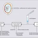 Diagnostic prénatal par amniocentèse - crédits : Encyclopædia Universalis France