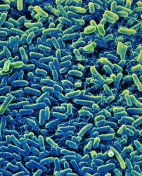 Tapis de salmonelles, microbes pathogènes - crédits : S. Lowry/ Univ Ulster/ The Image Bank/ Getty Images
