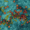 Virus de l'hépatite B - crédits : © Oliver Meckes and Ottawa—Photo Researchers, Inc.