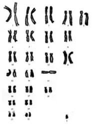 Chromosome X surnuméraire - crédits : © NHGRI