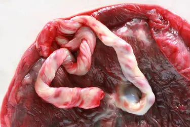 Placenta - crédits : © H. Dimyadi/ Shutterstock