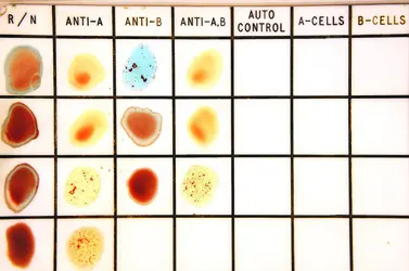 Typage des groupes sanguins - crédits : © Enciktat/ Shutterstock