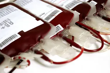 Poches de sang pour transfusion - crédits : © Vladm/ Shutterstock