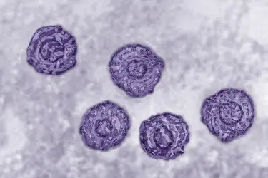 Virus de l’hépatite C - crédits : BSIP/ Universal Images Group/ Getty Images