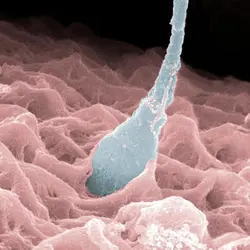 Spermatozoïde pénétrant un ovocyte - crédits : clouds hill imaging ltd/ SPL/ Getty Images