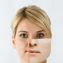 Traitement des séquelles de l’acné - crédits : berekin/ Getty Images